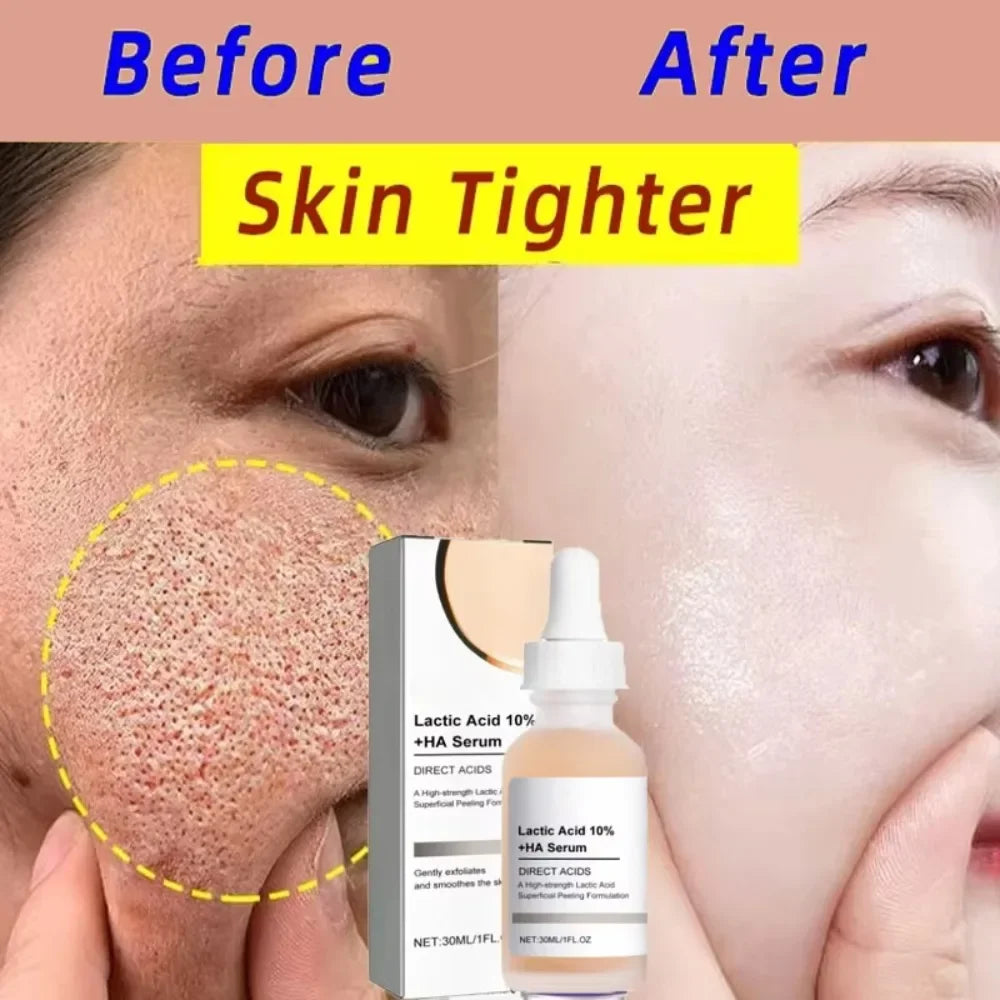 Lactic Acid Large Pores Removal Serum Pore Shrinking Minimizing Essence Moisturizing Firming Smooth Repair Korean Skin Care
